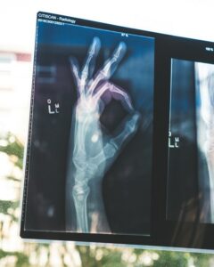 Featured image for “La persona trabajadora ya no está obligada a tramitar sus partes de baja médica”